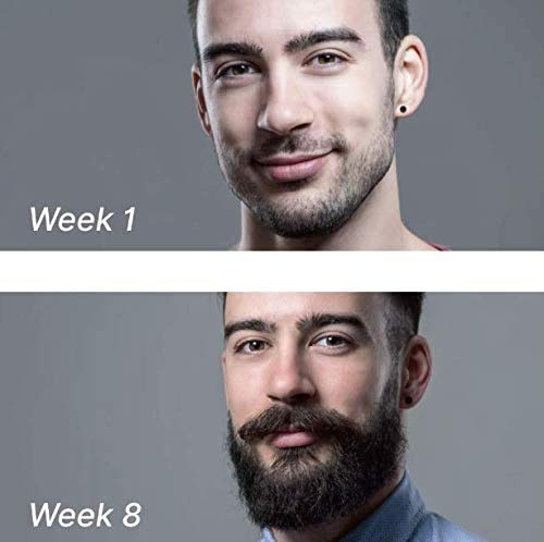 Beard Growth Roller/Derma Roller for Men/Microneedle Roller /540 0.5MM Titanium Needles (0.5mm)