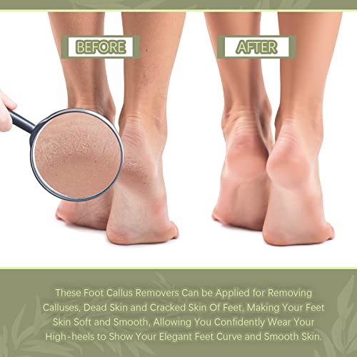 Double Sided Foot File Pedicure Foot Care Repair Tool Reusable Foot Scraper Hard Skin Remover Calluses Dead Skin Remover for Feet Foot Rasp File