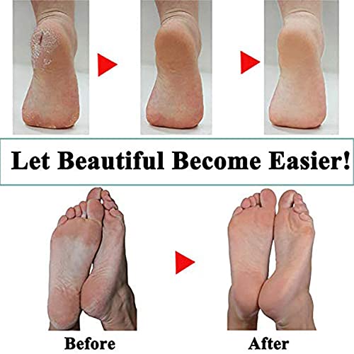 Hsthe Sea 4 Pack Extra Coarse Mineral Replacement Rollers Mineral Replacement Rolls for Emjoi Micro Pedi Callus Remover Refill Rollers (grey)