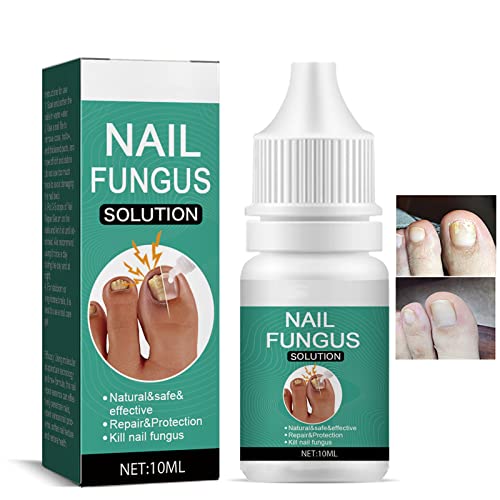 Fungal Nail Treatment for Toenail Extra Strong, Safety Effective Nail Fungus Solution, Ingrown Toenail Treatment Nail Care Oils, Anti Toe Toenail