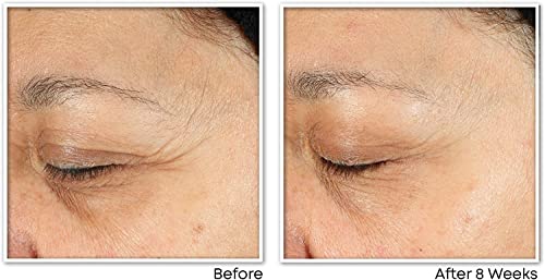 RoC - Multi Correxion Revive + Glow Vitamin C Daily Serum - Anti Wrinkle, Ageing and Skin Tone Treatment - Firming Moisturiser - 30ml