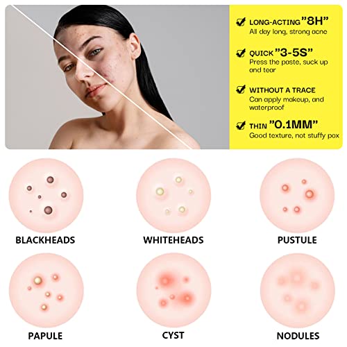 Hydrocolloid Acne Patch, Large Pimple Patch Spot Control Cover, Acne Patch for Covering Large Breakouts, Spot Patch, Pimple Stickers for Body, Ch