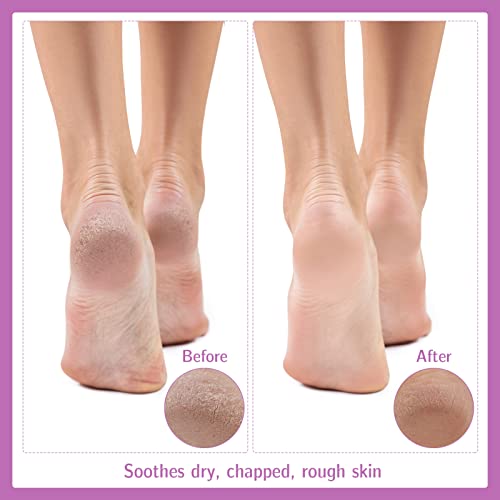 Dacitiery 5 Pairs Moisturizing Socks Overnight, Thin Foot Spa Socks Cotton Moisture Enhancing Socks Cosmetic Moisturizing Socks for Dry Cracked F