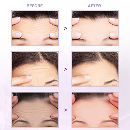 Forehead Patches for Wrinkles,Forehead Wrinkle Patches,Facial Anti-wrinkle Patches,Facial Wrinkle Patches,Facial Patches for Wrinkles,Anti-Wrinkl