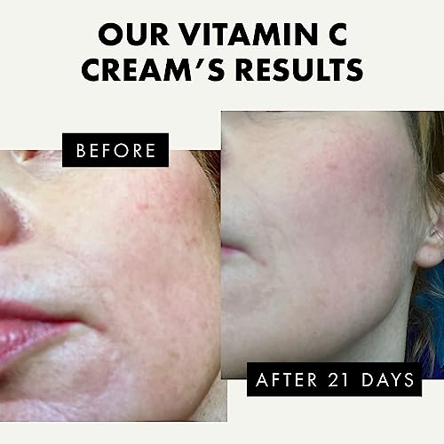 Organic Vitamin C Face Cream with Hyaluronic Acid & Retinol - Anti Ageing Moisturiser Cream with 20% Vitamin C for Women and Men - Brightening, F