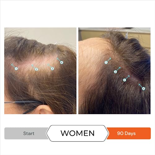 DS LABORATORIES Revita High Performance Hair Stimulating Shampoo 205 Milliliter Anti-Hair Loss