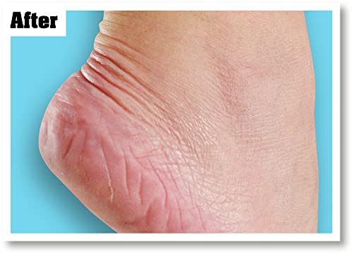 O'Keeffe's Healthy Feet, 80ml – Foot Cream for Extremely Dry, Cracked Feet | Instantly Boosts Moisture Levels, Creates a Protective Layer & Preve