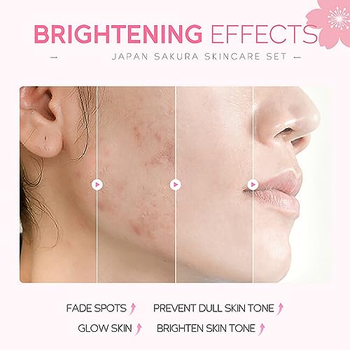 Skincare Gifts For Teenage Girls,Cherry Blossom Skincare Sets,Facial kit,Pamper Sets For Women Gifts,Skin Care Sets & Kits with Cleanser, Face Se