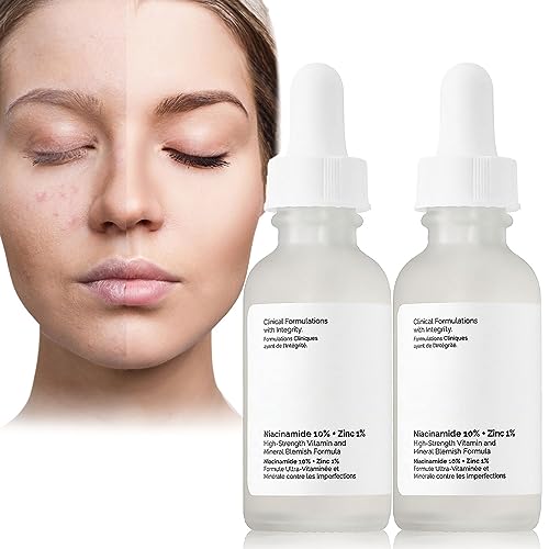 Niacinamide10%+Zinc 1%,Tackles Blemishes, Pore Reducer Face Serum,Minimises Pore, Brightening Serum for Blemish-Prone,Dull Skin, Softens & Bright