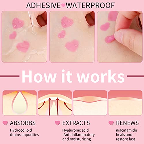 Fuyamp 54 Pcs Pimple Patches, Pink Love Heart Acne Spot Patch with Niacinamide and Hyaluronic acid, Moisturizing, Blemish Spot, Fast Healing Acne