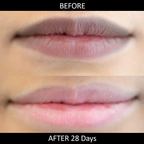 Omorfee 100% Organic Lip Lightening Balm, Lip balm for Dark Lips, Lip Balm with SPF, Natural Lip Protection, Lip Repair, Lip Moisturizer, Carrot