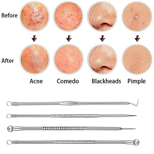 Blackhead Remover Tool Kit,8 Pieces Comedone Extractor Tool Blemish Whitehead Removal Acne Needle Pimple Spot Popper Stainless Steel (Sliver) (An