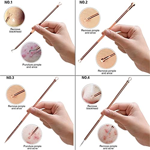 Blackhead Remover Tool, 4Pcs Comedone Extractor Tool Acne Removal Kit Pimple Popper Tool Kit Acne Needles Double Side Spot Squeezer Tool for Pimp