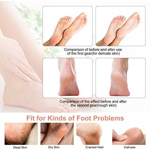 Pretfy Foot File, Electric Foot Callus Remover Rechargeable Pedicure Tool, 10 in 1 Electric Pedicure Feet Callus Remover Foot Care For Dead Skin