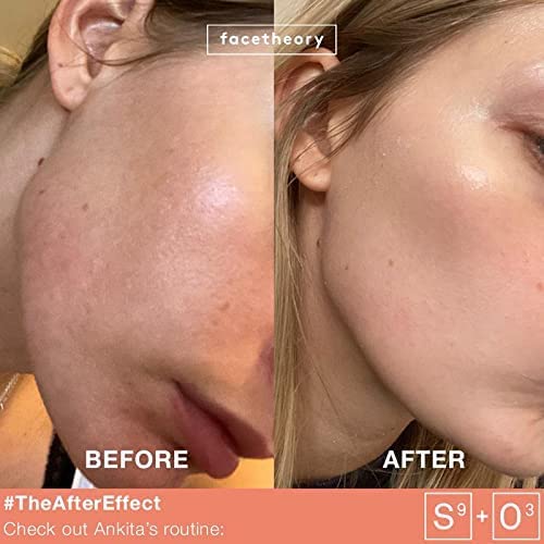 facetheory Balancing Rosehip Oil O3 - Organic Face Oil, Rosehip Oil For Face, Soften Dry Skin, Regulate Oil Production, Vitamin E, Vegan & Cruelt