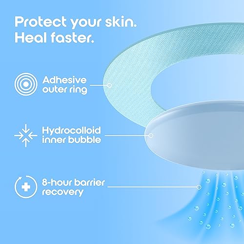 Spot Patches by Patch Perfect® (102 Pimple Patches) - Acne Patch with Absorbing Hydrocolloid Dots for Spot Treatment - Translucent Spot Stickers,