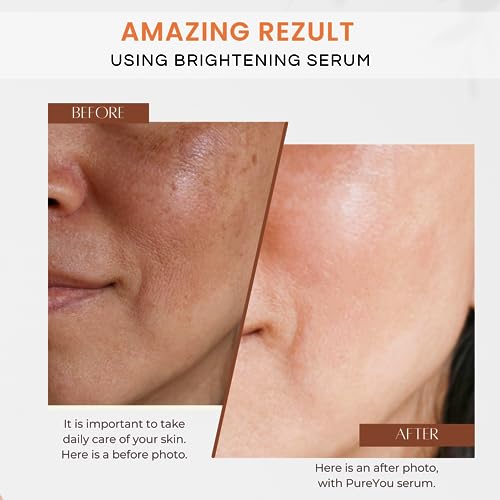 Natural Vitamin C Serum for Face- with Hyaluronic Acid, Ferulic Acid, Vitamin E - Premium Anti Aging & Anti Wrinkle Serum with Antioxidant Benefi