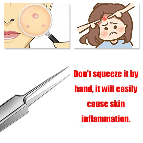 Professional Comedones Extractors Stainless Steel Ingrown Hair Tweezers Blackhead Remover Splinter Sharp Tip Tweezers for Acne