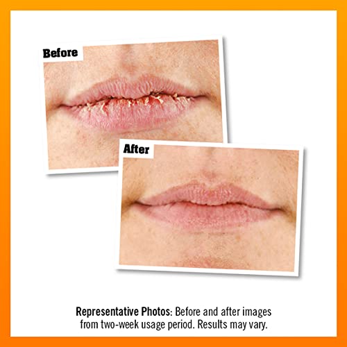 O'Keeffe's Lip Repair Unscented Lip Balm, 4.2g – For Extremely Dry, Cracked Lips | All-Day Moisture with 7 Moisturising Ingredients