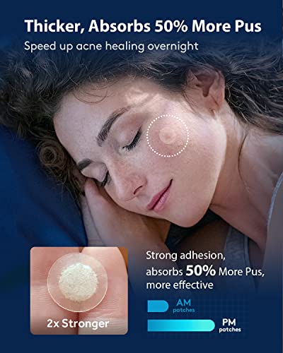 LitBear Acne Pimple Patches- Day and Night 4 Sizes 180 Dots Thin & Thick Hydrocolloid Patches with Witch Hazel, Tea Tree & Calendula Oil, Extra A