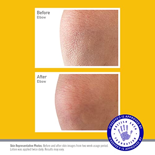 O'Keeffe's Skin Relief & Repair Pump, 325ml – Body Lotion for Extremely Dry, Itchy Skin | Unscented, Non-Greasy & Clinically Tested