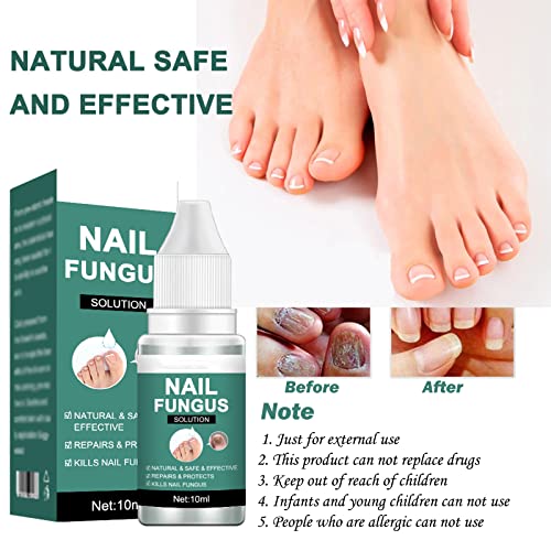Fungal Nail Treatment for Toenail Extra Strong, Safety Effective Nail Fungus Solution, Ingrown Toenail Treatment Nail Care Oils, Anti Toe Toenail