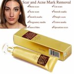 SkinRosa Scar Removal Cream and Acne Treatment Cream - Effectively Remove Acne and Scars like Burns, Cuts, Pregnancy Stretch Marks, Acne Spots, S