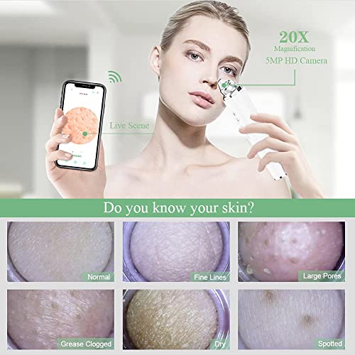 Blackhead Remover Pore Vacuum, Upgraded WIFI Visible Facial Pore Cleanser with HD Camera Pimple Acne Comedone Extractor Kit with 6 Suction Heads