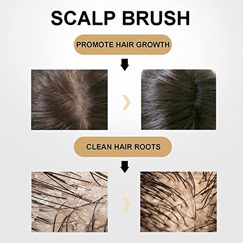 Hair Brush-Hair Scalp Massager Shampoo Brush, Detangling Brush for Women Girls - Detangler Hair Brush for Straight Long Wet Dry Hair, Scalp Brush