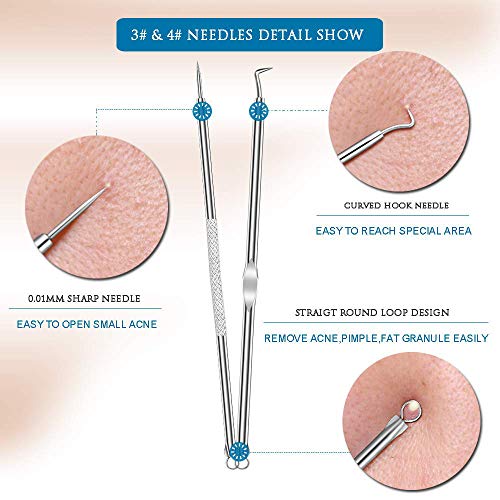 Blackhead Remover Kit, Extractor Removal Set Professional Stainless Steel Pimple Popper Tool Treatment for Whitehead Blemish Acne Comedone Pimple