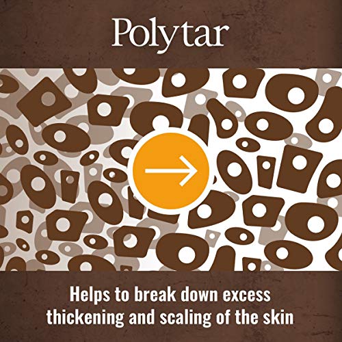Polytar Scalp Shampoo 150ml, Treats Psoriasis, Seborrhoeic Dermatitis, Eczema, and Dandruff, Soothes Itchy, Scaly Scalps, Contains Coal Tar