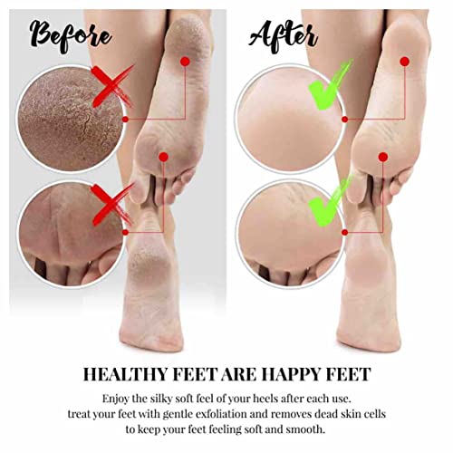 Pumice Stone by RustiK, Natural Volcanic Rock, Home Pedicure, Exfoliation, Skin Care, Corns, Callus.