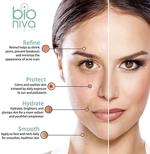 Retinol Serum - Retinol Liposome Delivery System with Vitamin C, Aloe, and Vegan Hyaluronic Acid - High Strength Anti Aging Serum for face, décol