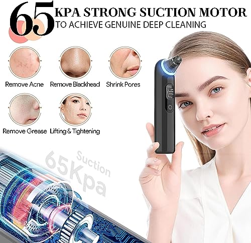 Blackhead Removers Vacuum Electric Blackhead Remover Pore Vacuum, 3 Levels and 4 Suction Heads Black Head Vacuum Remove Kit with Blue Light, Pore