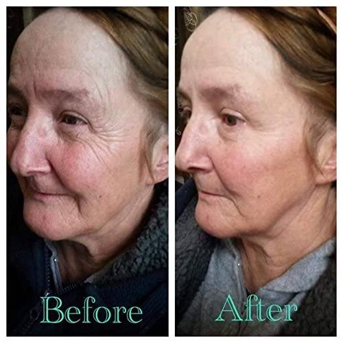 Jeunesse Instantly Ageless 10 Vial - Immediately reduces the appearance of under-eye bags, fine lines, wrinkles and pores, and lasts 6 to 9 hours