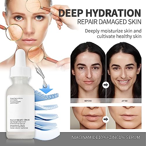 Niacinamide10%+Zinc 1%,Tackles Blemishes, Pore Reducer Face Serum,Minimises Pore, Brightening Serum for Blemish-Prone,Dull Skin, Softens & Bright