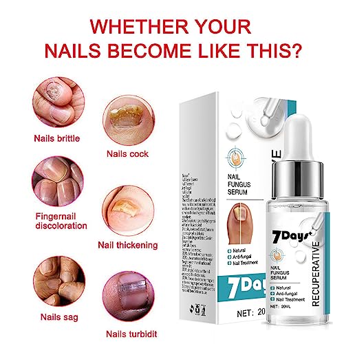 Fungal Nail Treatment For Toenails - Extra Strong Extra Strong Nail Fungus Treatment for Toenail - Fingernail & Toenail Care Solution - Fix & Ren