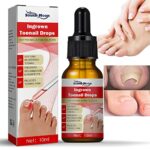 Nail Helper ingrown toenail treatment,nail growth treatment,treatment for ingrown toenail Ingrown Toenail Drops,ingrowing toenail treatment，ingro