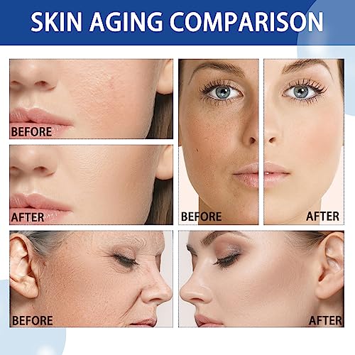 Face Moisturiser, 10% Niacinamide Serum+ 1% Zinc Serum, High-Strength Vitamin to Control Excess Oil and Redness, Tackles Blemishes, Minimises Por