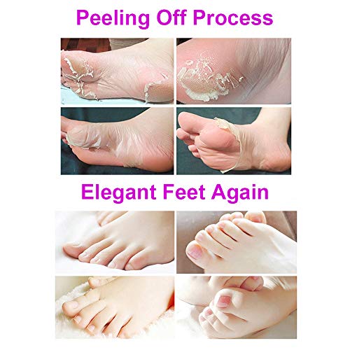 BOMPOW Foot Peel Mask, Exfoliating Socks Foot Mask, Peel Off Dry Dead Cracked Hard Skin in 3-7 Days, Lavender Scented Exfoliating Foot Socks, 2 P