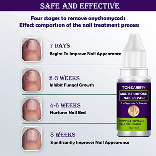 Nail Fungus Treatment, Fungal nail treatment for Toenail Extra Strong, Multi-Purpose Nail Repair for Fingernails Toenails, Nail Fungal Treatment