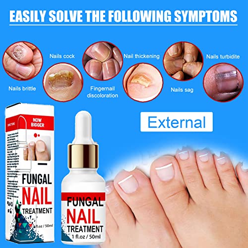 Fungal Nail Treatment for Toenails Extra Strong, Toenail Fungus Treatment Nail Repair for Fingernails Toenails, Toe Nail Fungal Treatment Fungal