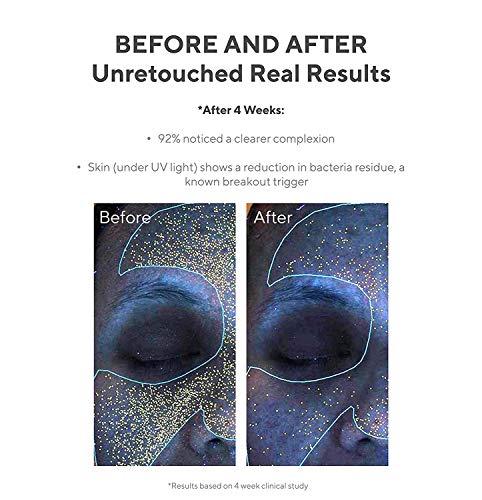 Murad Clarifying Water Gel Hydrating Face Moisturiser with Non-Greasy Finish 47ml