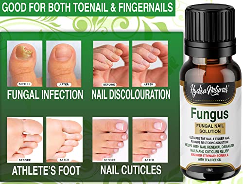 Hydra Naturals Nail Fungus Treatment, Nail Renewal - Maximum Strength Nail Care Solution for Finger & Toenail Fungus, Athlete's Foot, Ringworm by