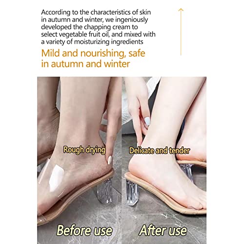 Cracking Cream Chapping Cream, Natural Winter Anti-Cracking Frost, Cracked Skin Repair Foot Cream Anti-Cracking Frost Feet Moisturizing, Cracked