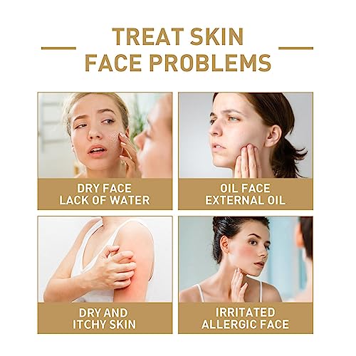 Rice Face Toner - 5.28fl oz Glow Boosting Essence, Rice Toner for Face, Natural Moisturizer Glow Essence, Hydrating and Moisturizing Rice Extract