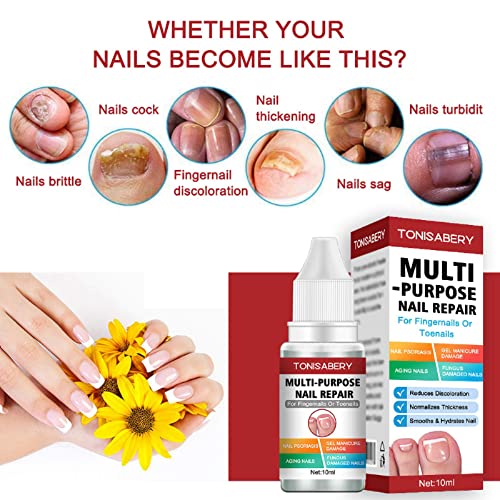Fungal Nail Treatment,Nail Fungus Treatment For Toenail,Toe Nail Fungal Treatment,Ingrown Toenail Treatment,Toenail Fungus Treatment For Toenails