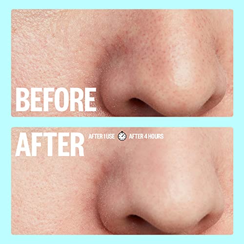 Peace Out Skincare Pores. Hydrocolloid Pore-Refining Nose and Face Strips with Vitamin A to Shrink Enlarged Pores and Remove Excess Oil (4 pore a