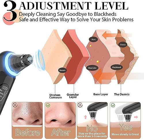 Blackhead Removers Vacuum Electric Blackhead Remover Pore Vacuum, 3 Levels and 4 Suction Heads Black Head Vacuum Remove Kit with Blue Light, Pore