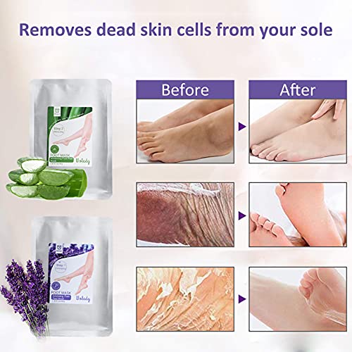 Foot Peeling Mask, Wolady Feet Peel Mask Exfoliating Socks Moisturizing Mask for Foot Care, Peeling Off Calluses & Dead Skin, Making Your Feet Sm